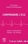 Comprendre l'ECG