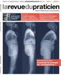 Thérapeutiques orthopédiques non chirurgicales du rachis chez le sujet âgé